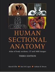 Атлас анатомии человека в срезах, Harold Ellis, Bari M Logan, Adrian Dixon, 2007