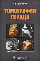 Томография сердца, Терновой С.К.